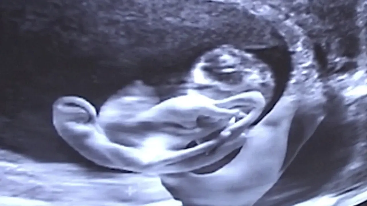 Castration Movie Anthology iii. Year of the Hyaena